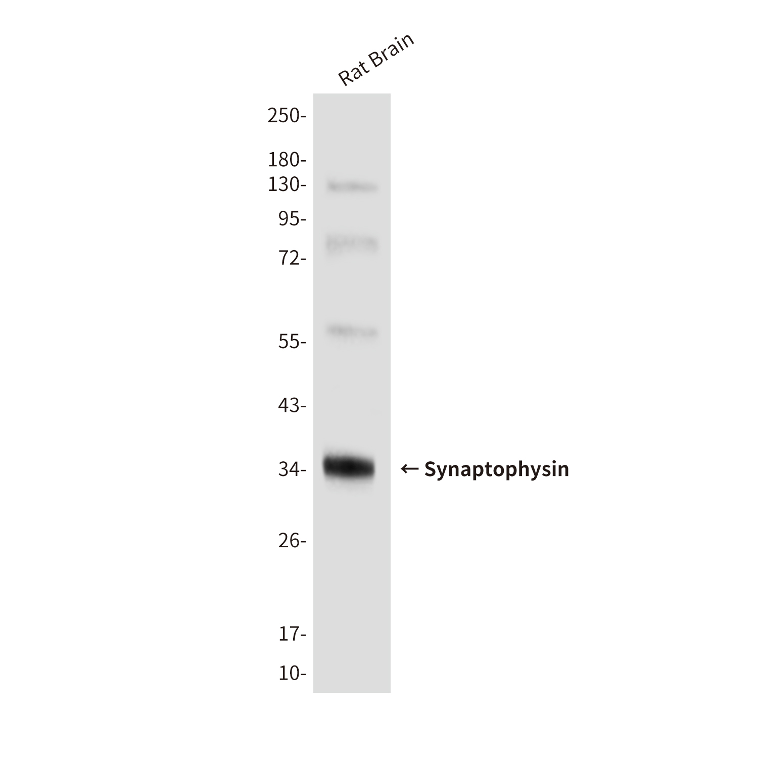 Synaptophysin (10C8) Mouse mAb ABZ4215