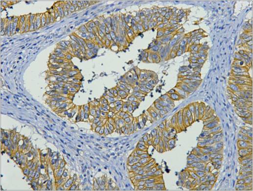 Cytokeratin 19  Mouse mAb ABZ4216
