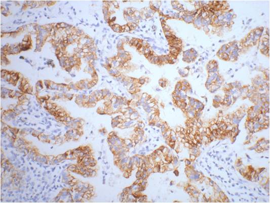 Cytokeratin 7 (9G9) Mouse mAb ABZ4217