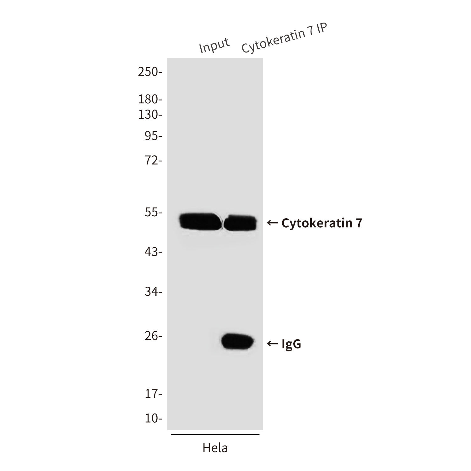 Cytokeratin 7 (9G9) Mouse mAb ABZ4217