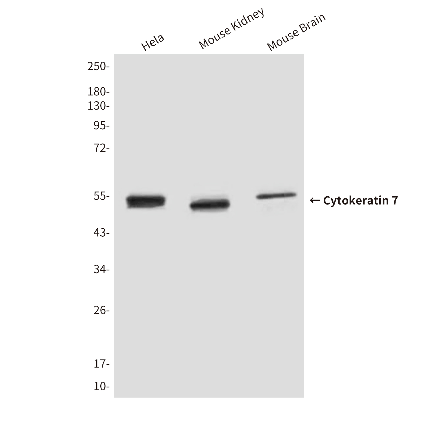 Cytokeratin 7 (9G9) Mouse mAb ABZ4217