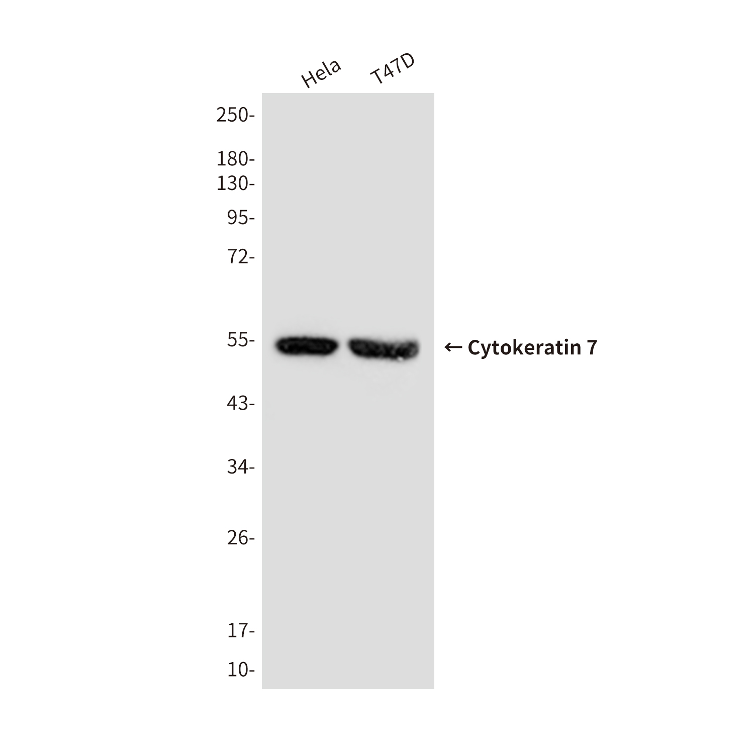 Cytokeratin 7 (9G9) Mouse mAb ABZ4217