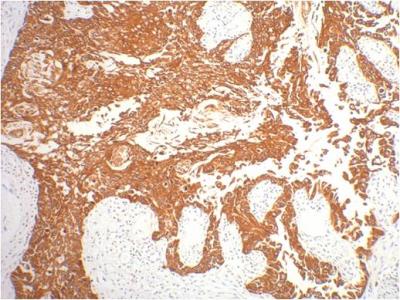 Cytokeratin 16/K16 Mouse mAb ABZ4218