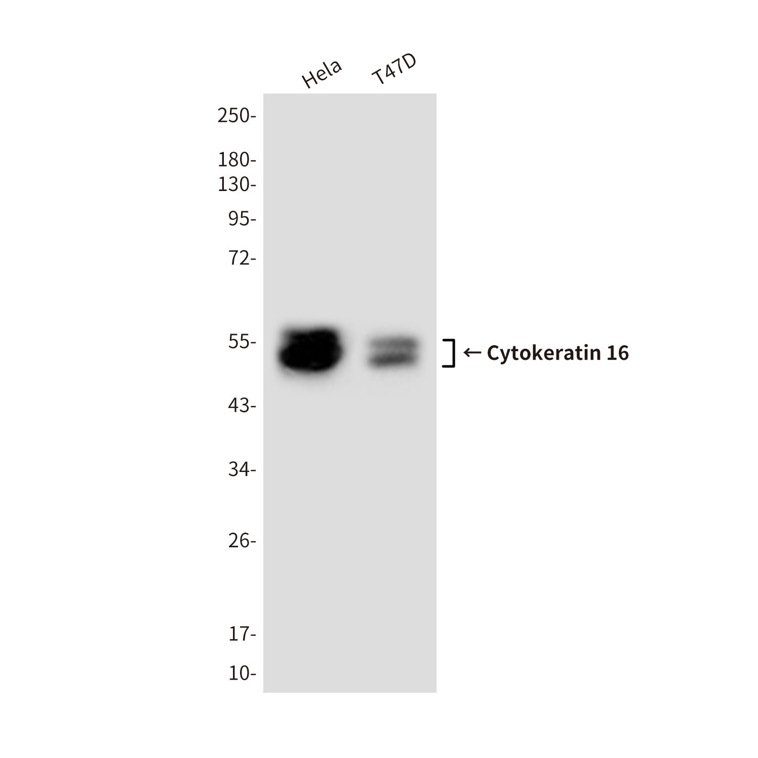 Cytokeratin 16/K16 Mouse mAb ABZ4218