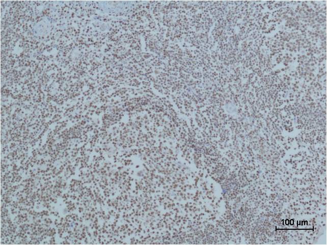 PARP1 (10C2) Mouse mAb ABZ4220