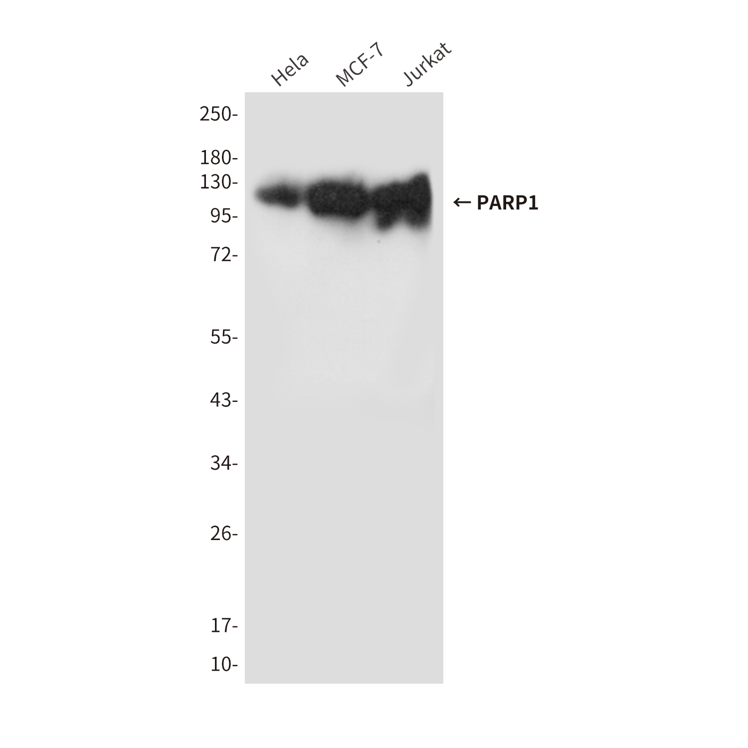 PARP1 (10C2) Mouse mAb ABZ4220