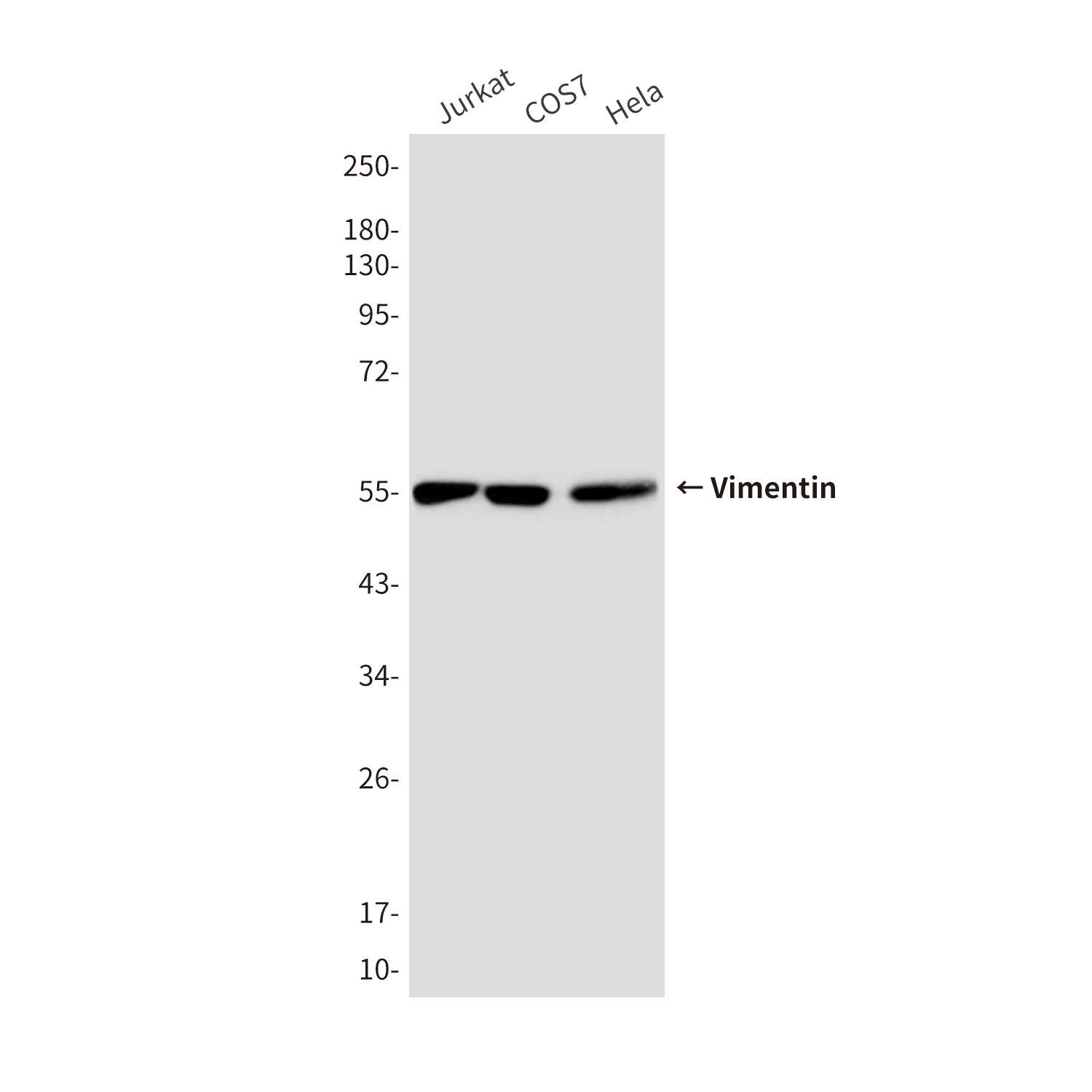 Vimentin (10E2) Mouse mAb ABZ4221