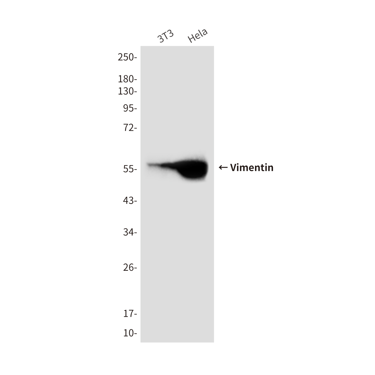 Vimentin (10E2) Mouse mAb ABZ4221