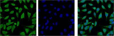 Hsp70 1A (1D9) Mouse mAb ABZ4222
