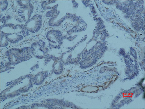 Survivin (8B9) Mouse mAb ABZ4223