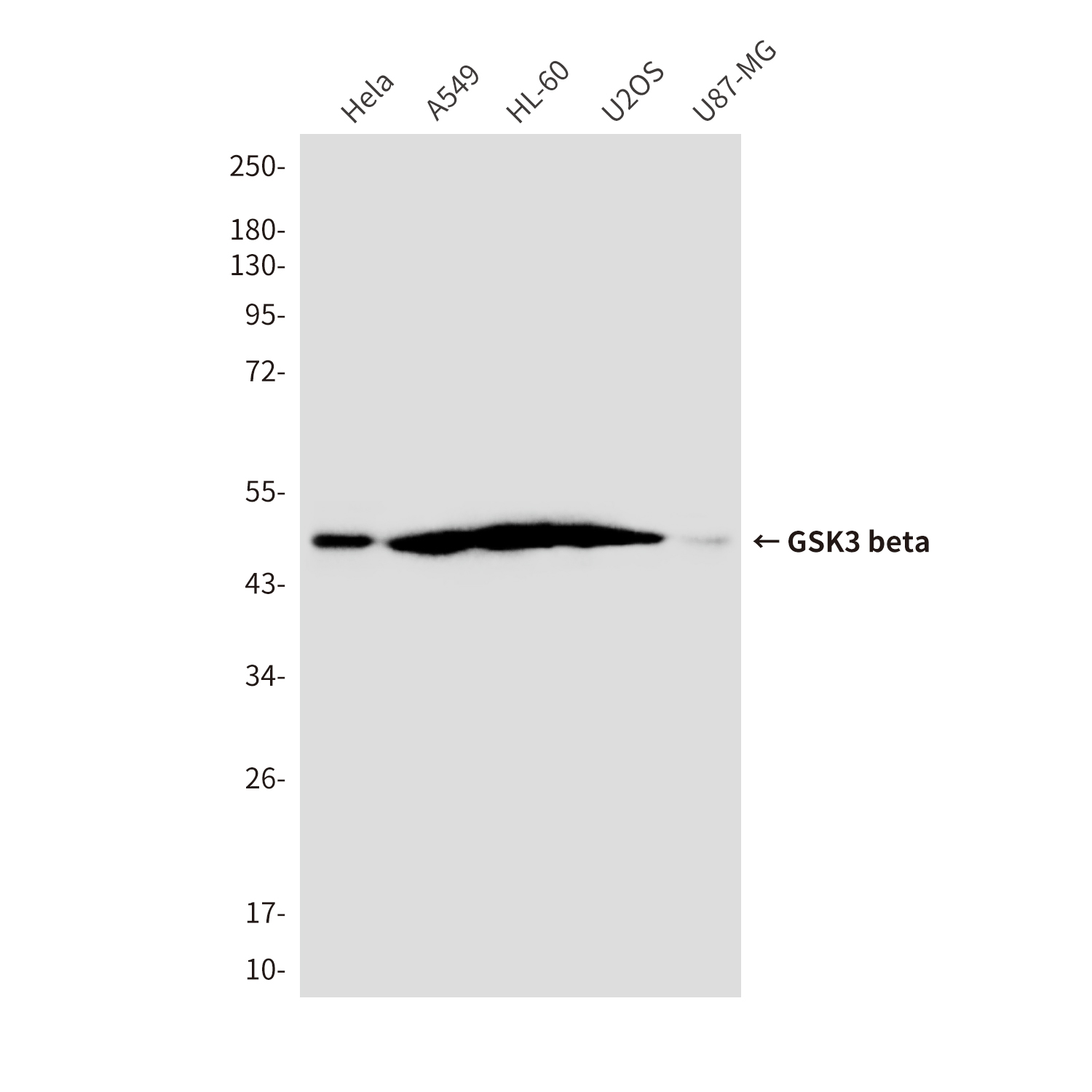 GSK3 beta (4C4) Mouse mAb ABZ4224
