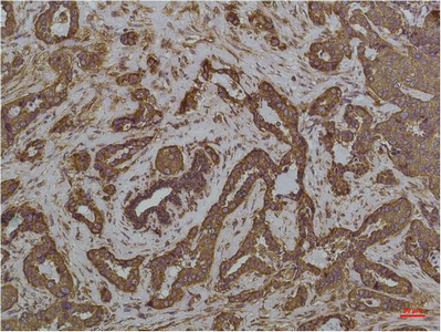 GRP78 BiP (6H7) Mouse mAb ABZ4232