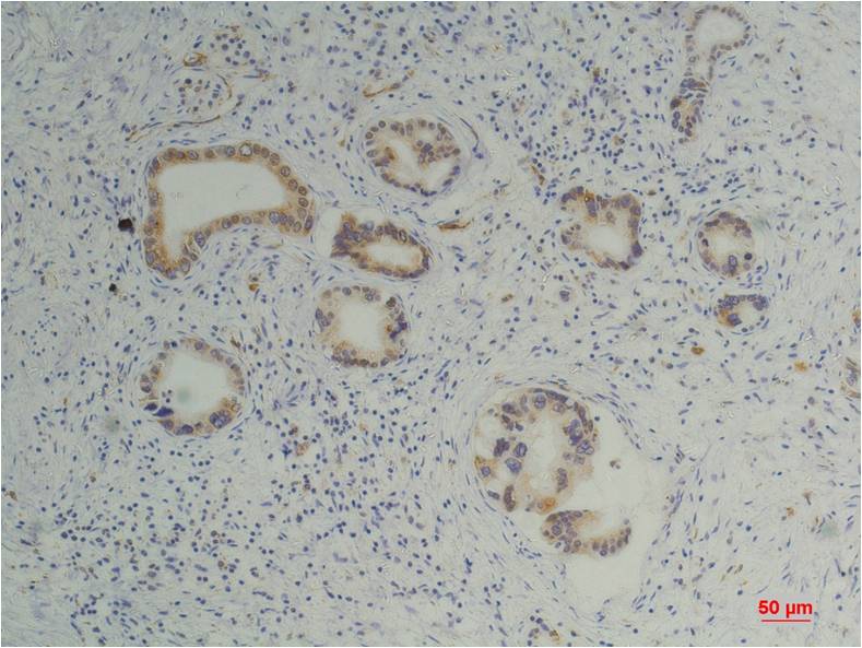 Cyclophilin B Mouse mAb ABZ4234