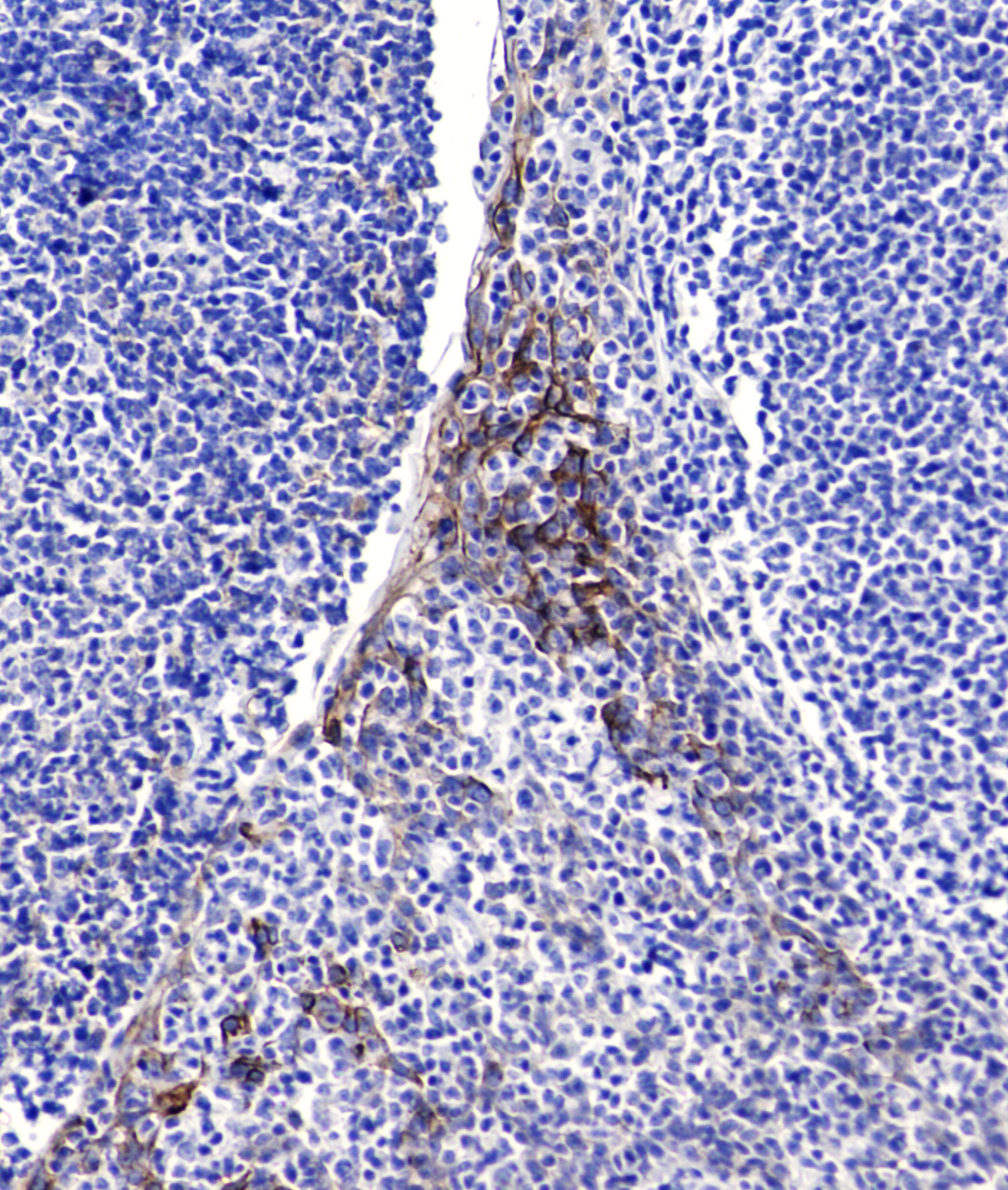 ICAM1 (1C7) Mouse mAb ABZ4236