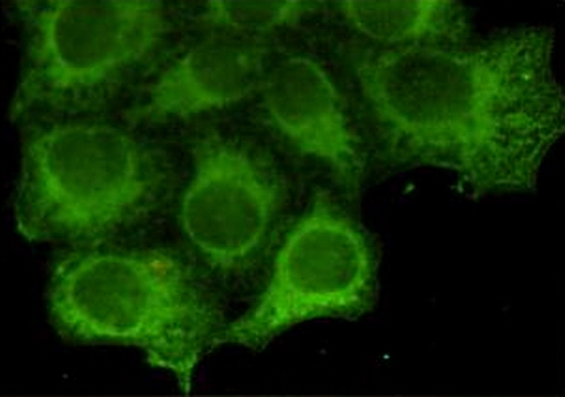 Cytokeratin 18 (2B5) Mouse mAb ABZ4238
