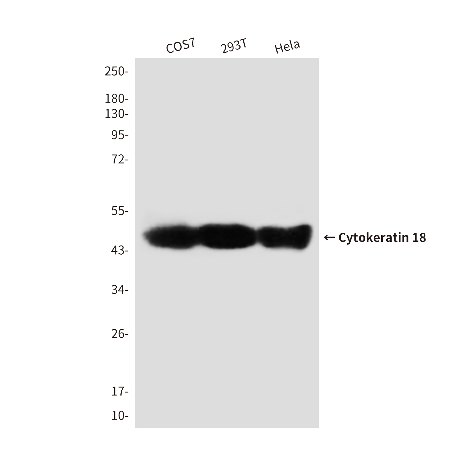 Cytokeratin 18 (2B5) Mouse mAb ABZ4238