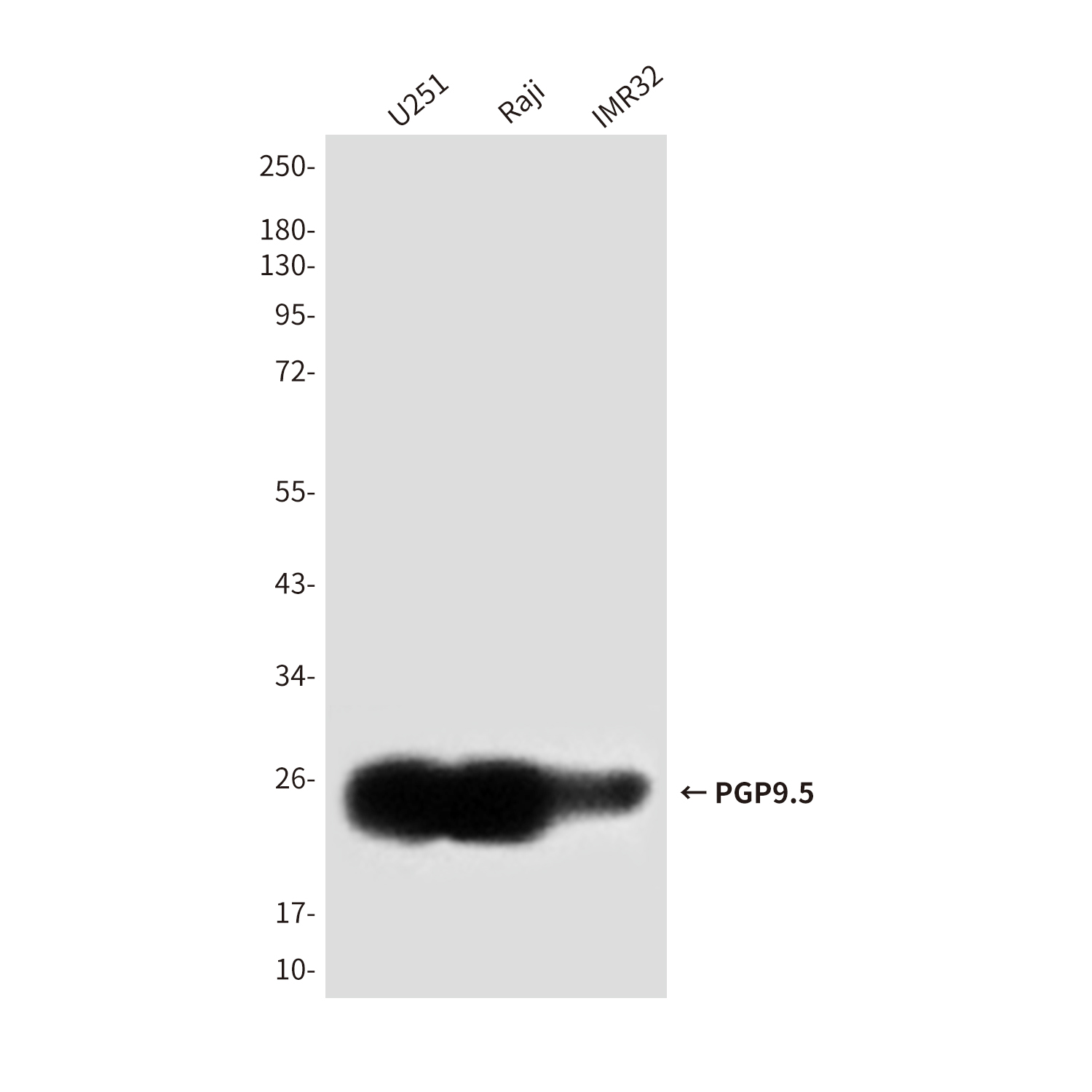 UCH-L1/PGP9.5 (7B8G5E7) Mouse mAb ABZ4244