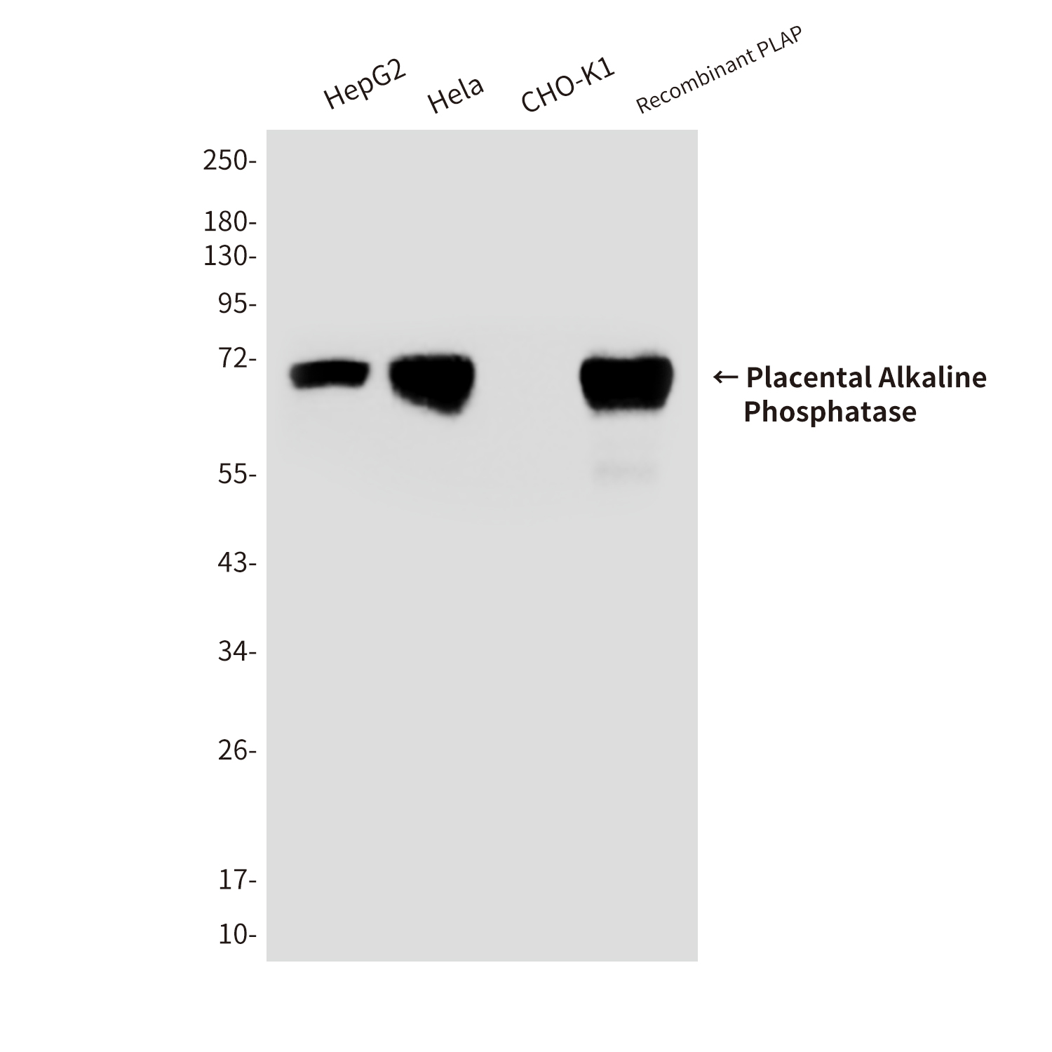 Placental Alkaline Phosphatase Mouse mAb ABZ4245