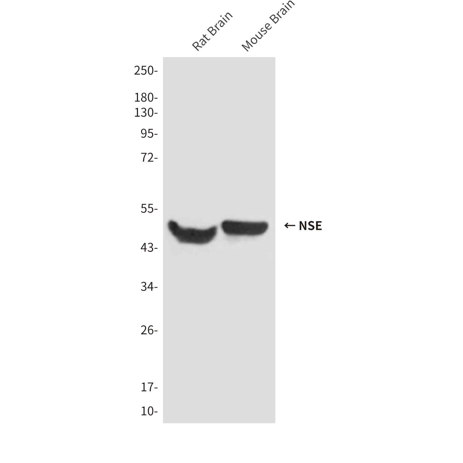 NSE Mouse mAb ABZ4251