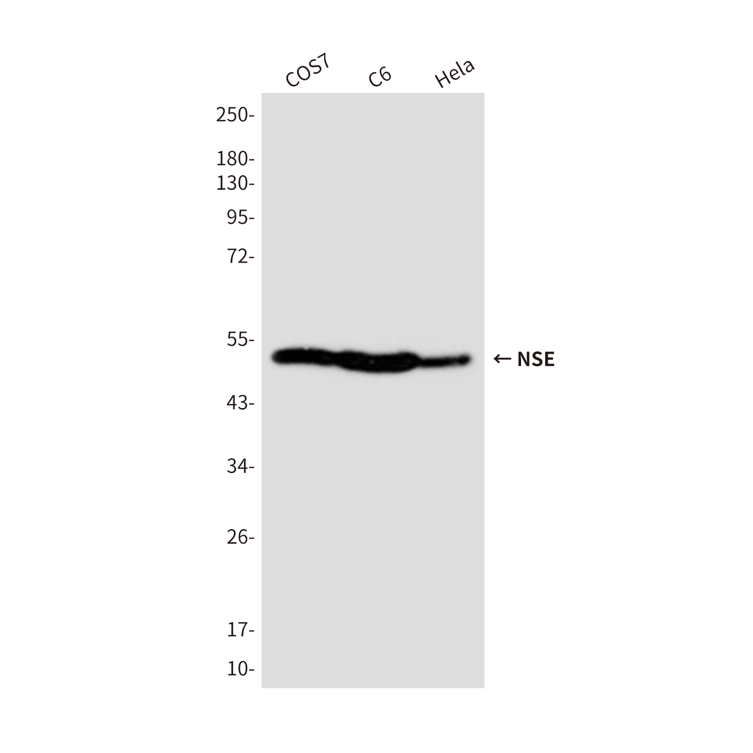 NSE Mouse mAb ABZ4258