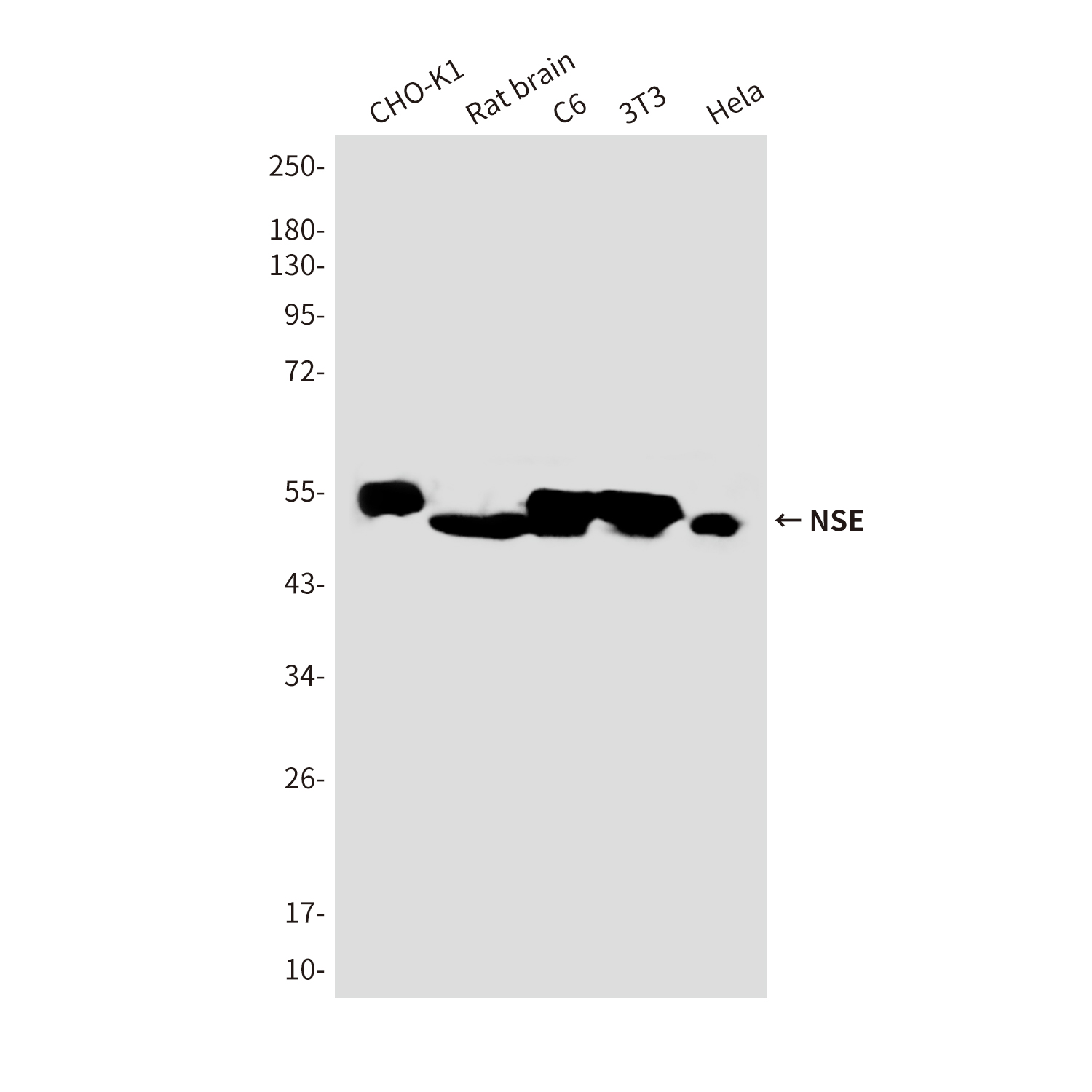 NSE Mouse mAb ABZ4258