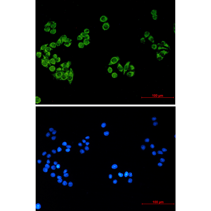 FH/Fumarase Mouse mAb ABZ4259