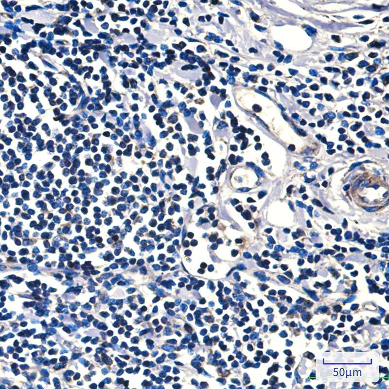 FH/Fumarase Mouse mAb ABZ4259