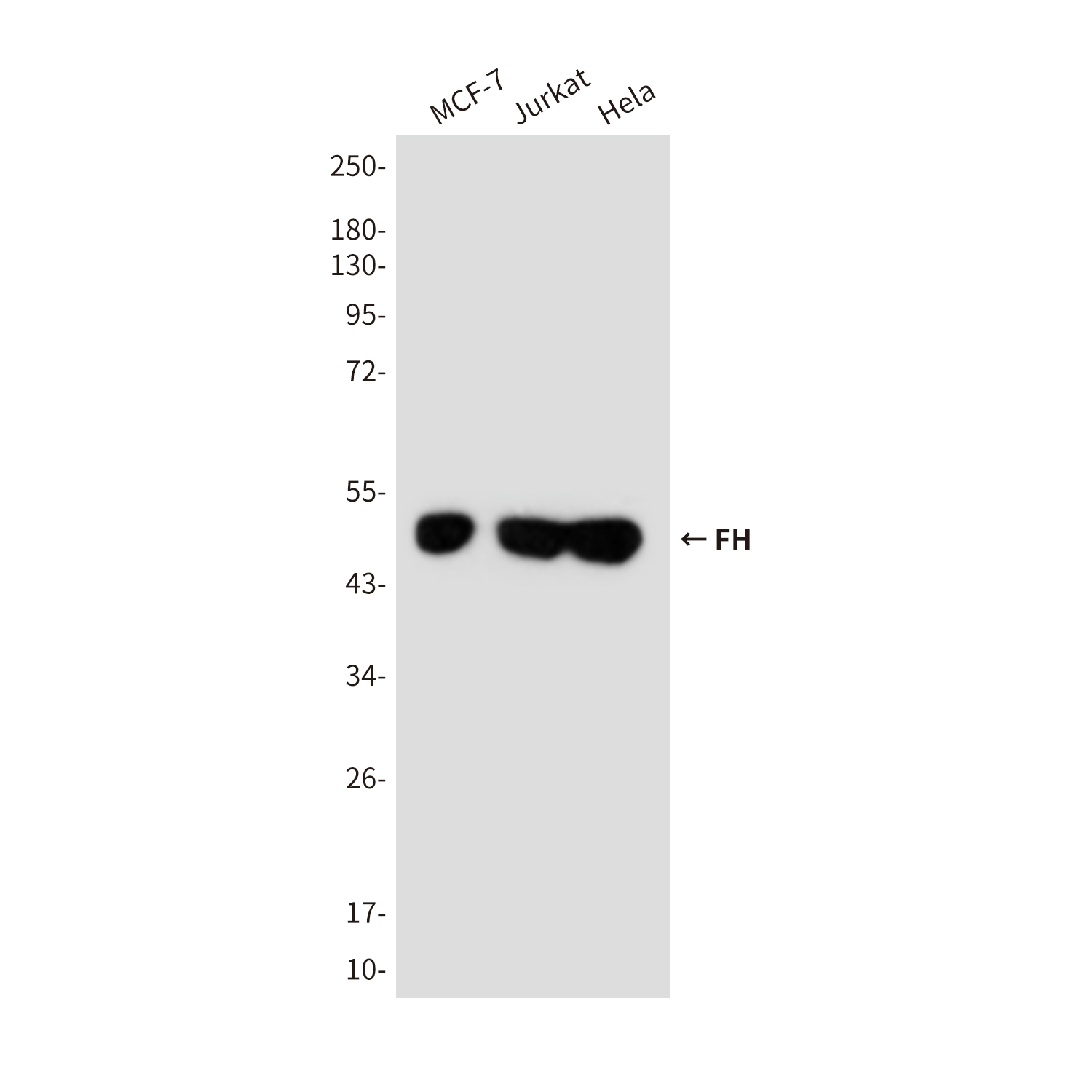 FH/Fumarase Mouse mAb ABZ4259
