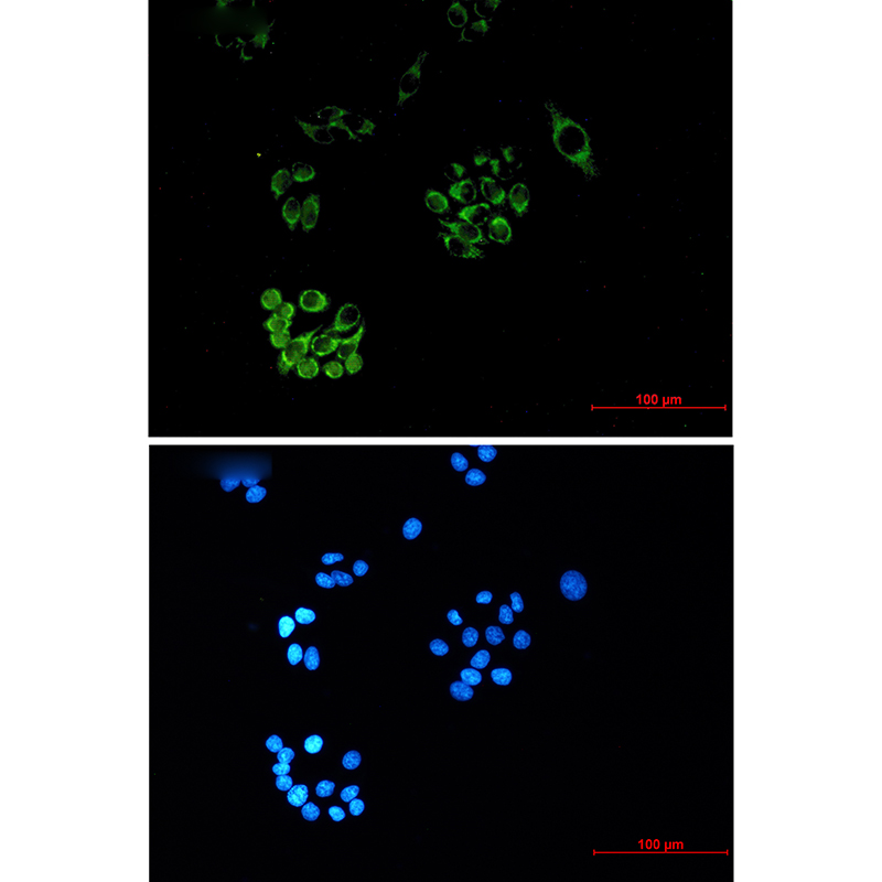 FH/Fumarase Mouse mAb ABZ4260