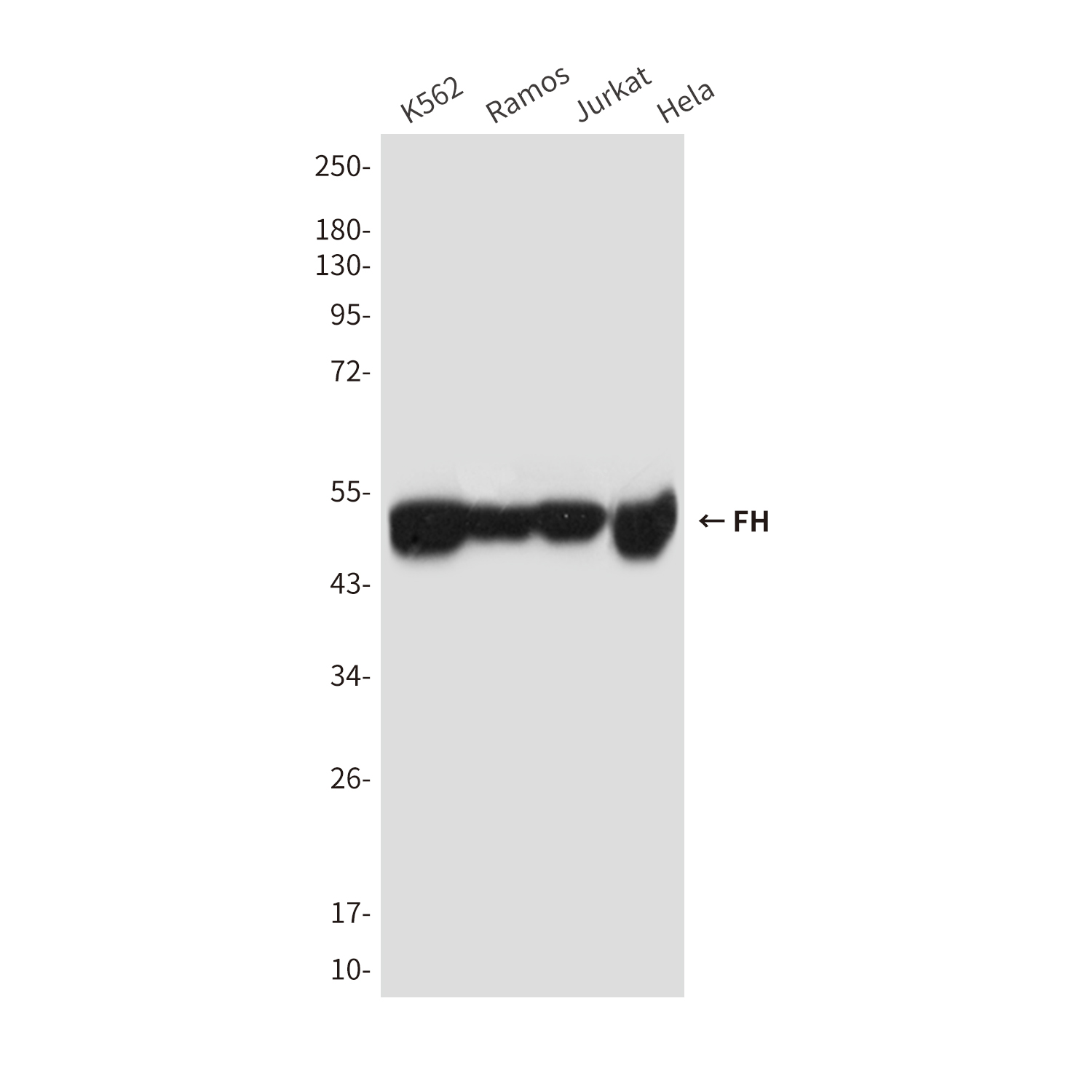 FH/Fumarase Mouse mAb ABZ4260