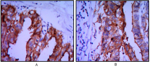 Placental Alkaline Phosphatase Mouse mAb ABZ4263