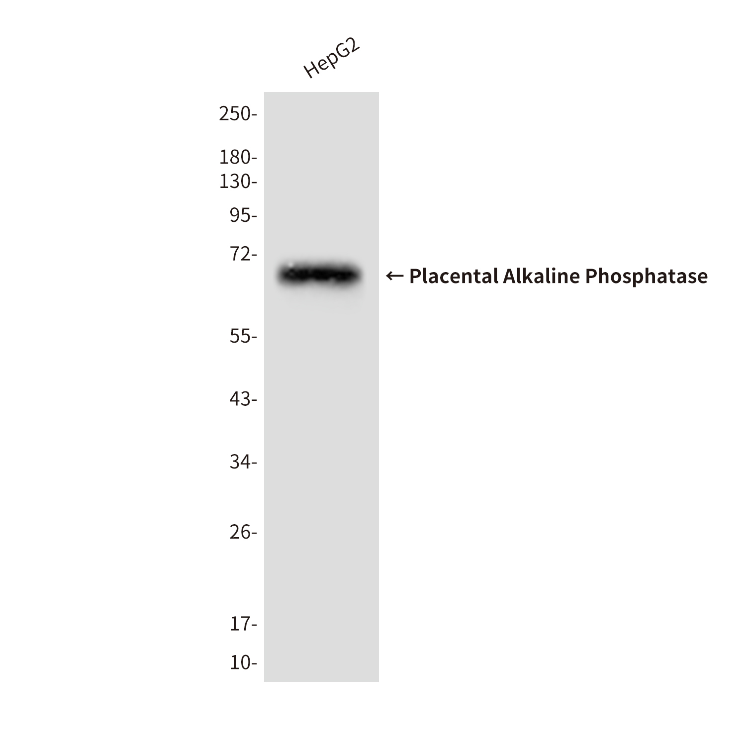 Placental Alkaline Phosphatase Mouse mAb ABZ4263