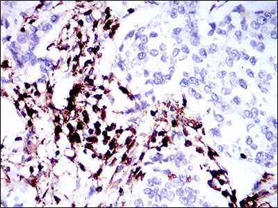 CD45 Mouse mAb ABZ4264