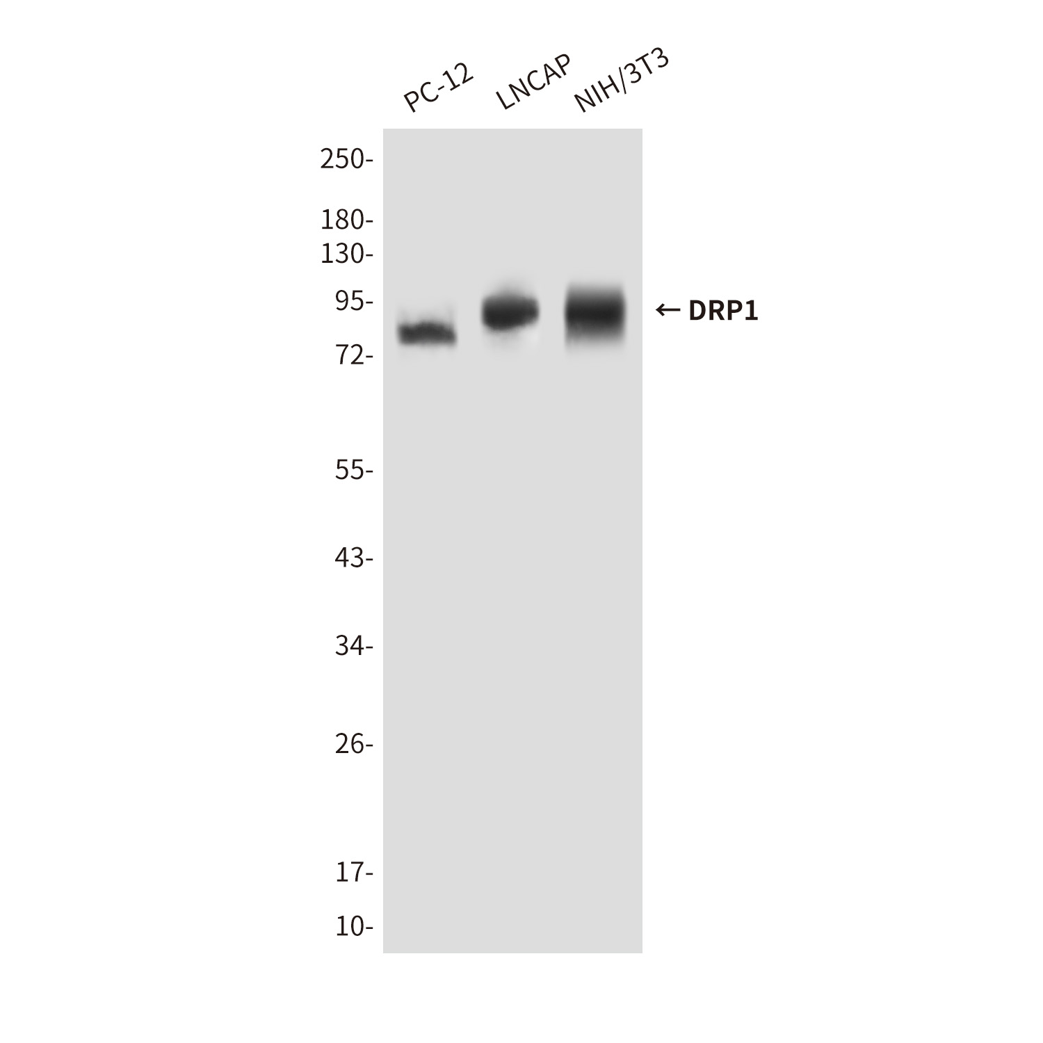 DRP1 Mouse mAb ABZ4265