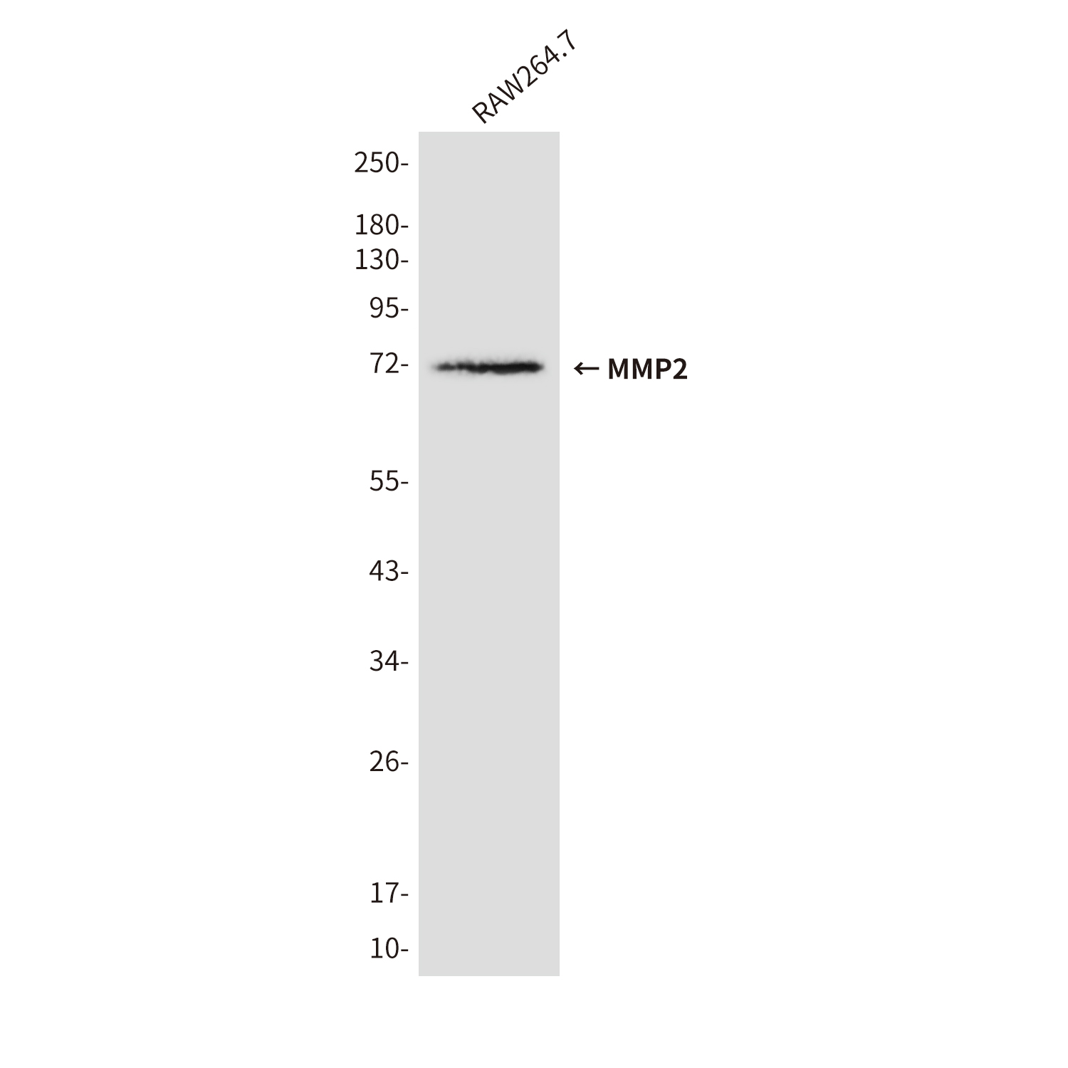 MMP2 (3A8) Mouse mAb ABZ4267