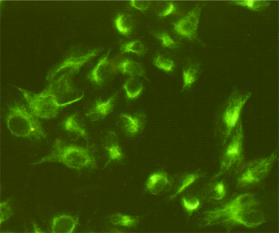 Vimentin (4F8) Mouse mAb ABZ4268