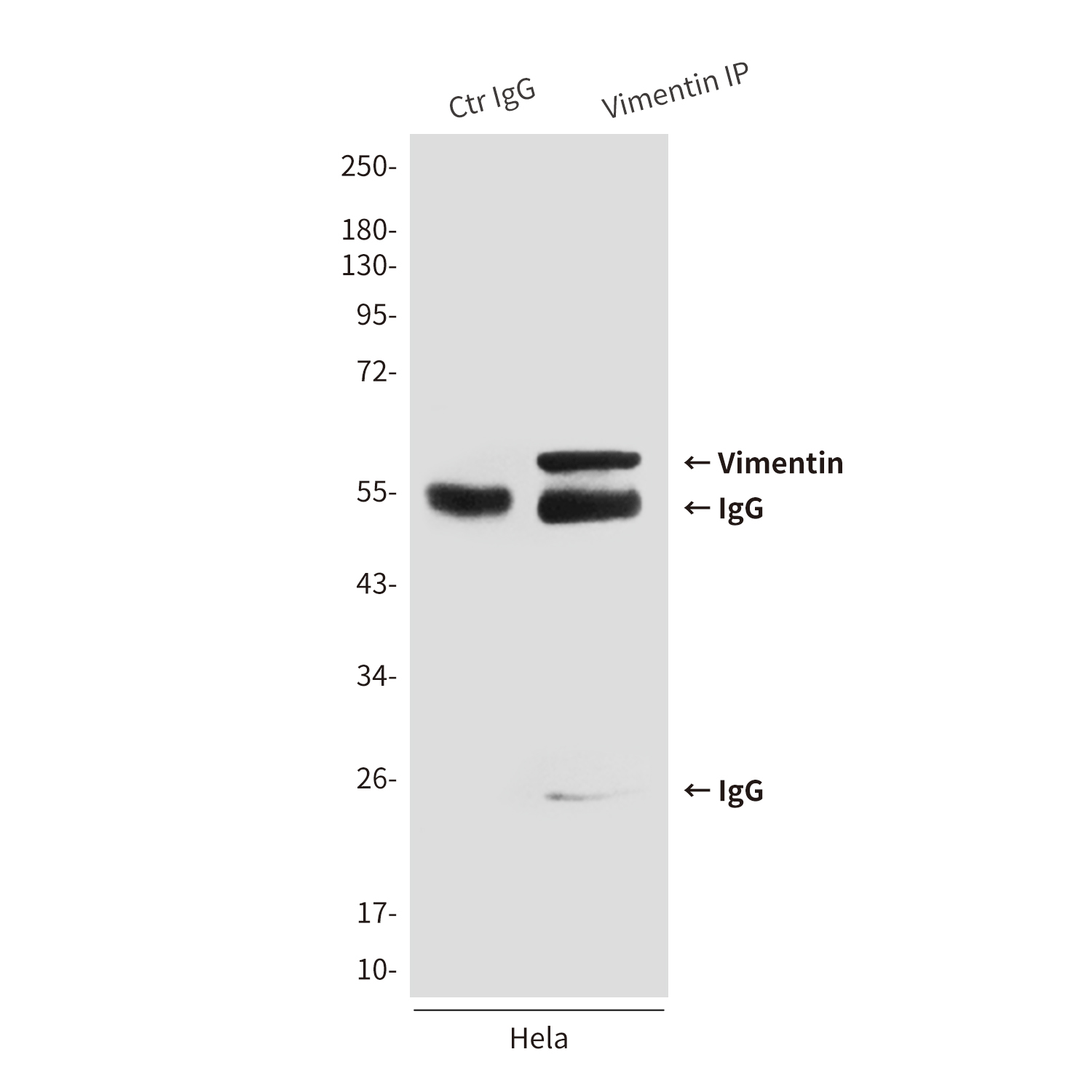 Vimentin (4F8) Mouse mAb ABZ4268