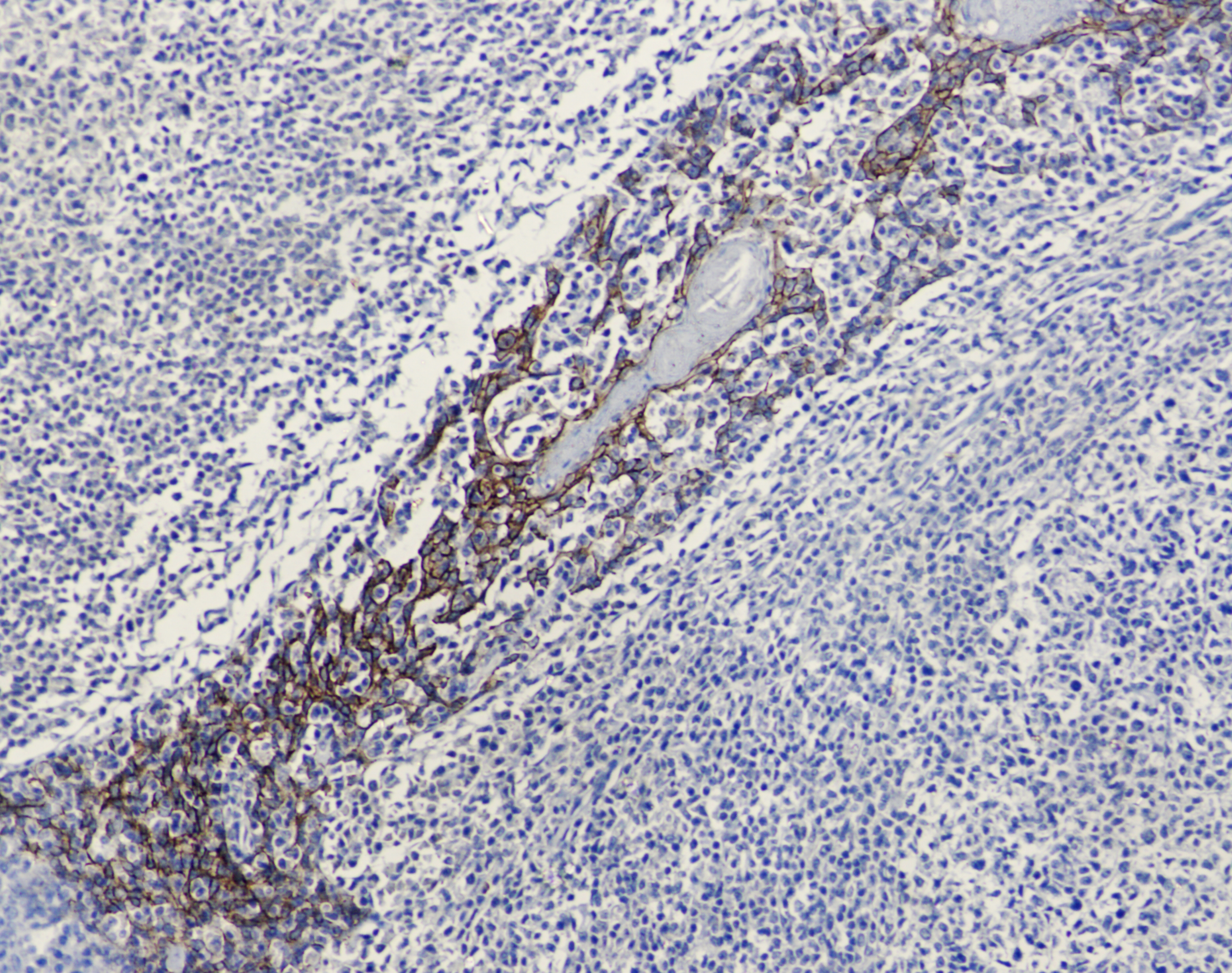 E Cadherin (6B10) Mouse mAb ABZ4269
