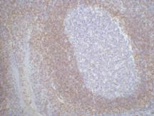 Bcl 2 (3H5) Mouse mAb ABZ4271