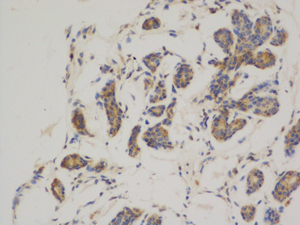 Bcl 2 (3H5) Mouse mAb ABZ4271