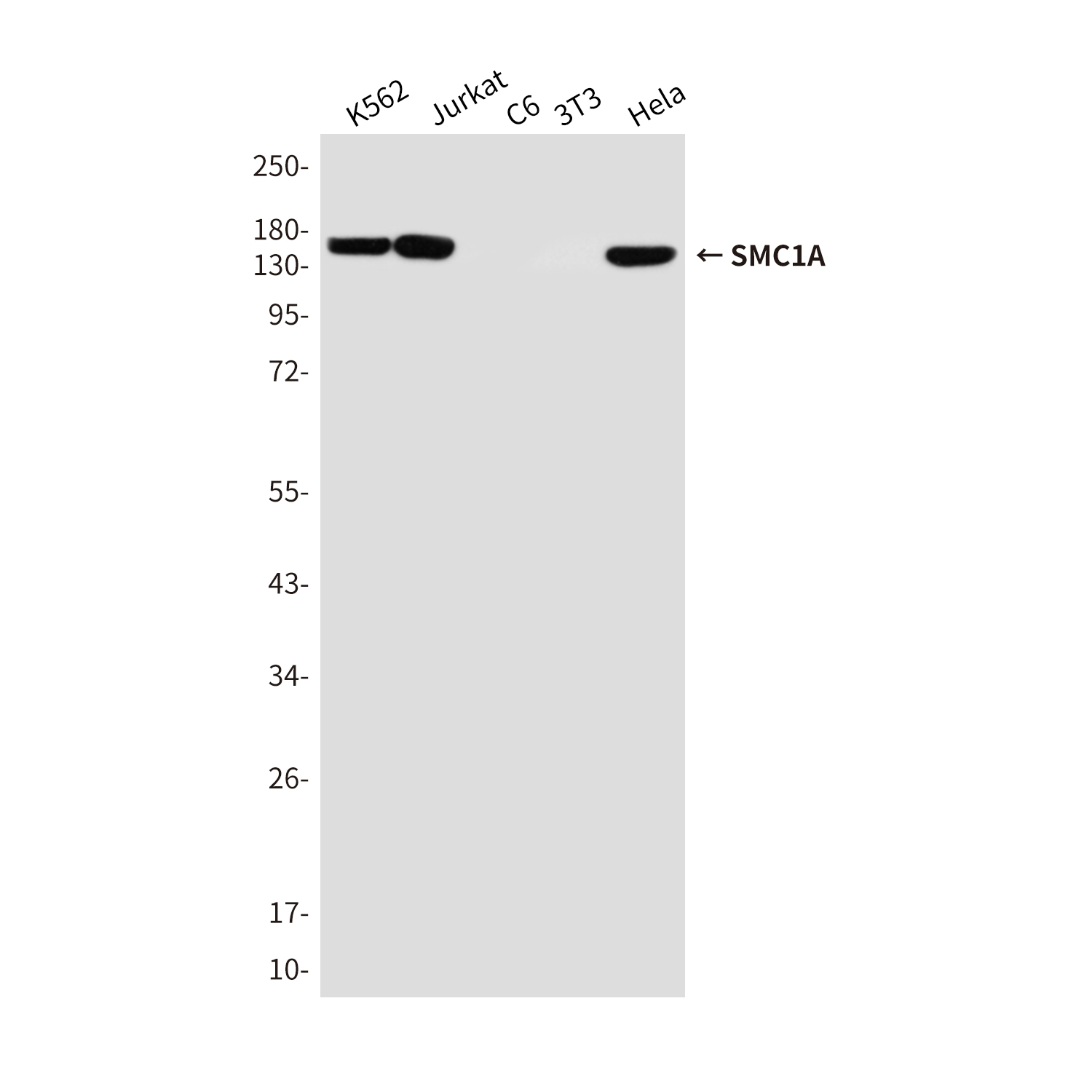 SMC1A Mouse mAb ABZ4273