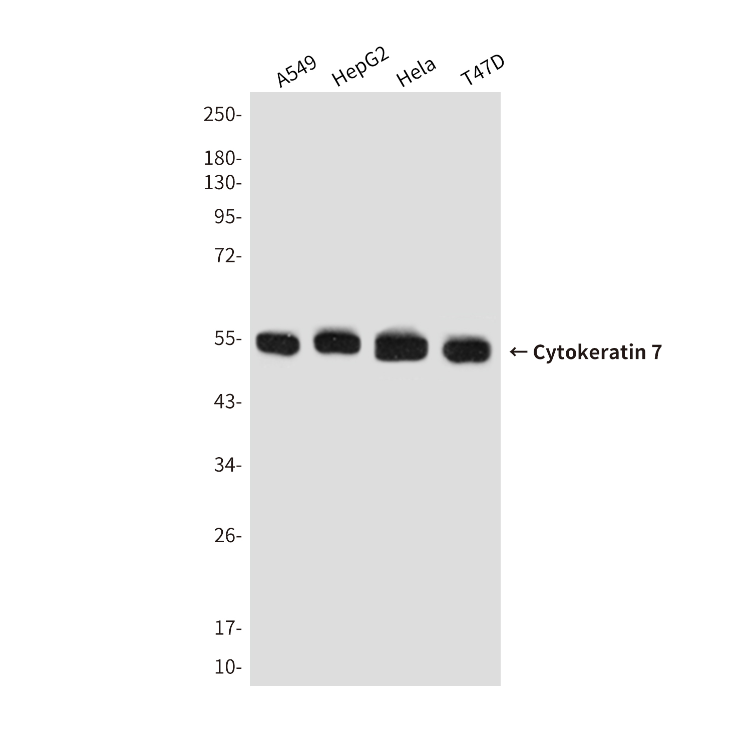 Cytokeratin 7 Mouse mAb ABZ4275