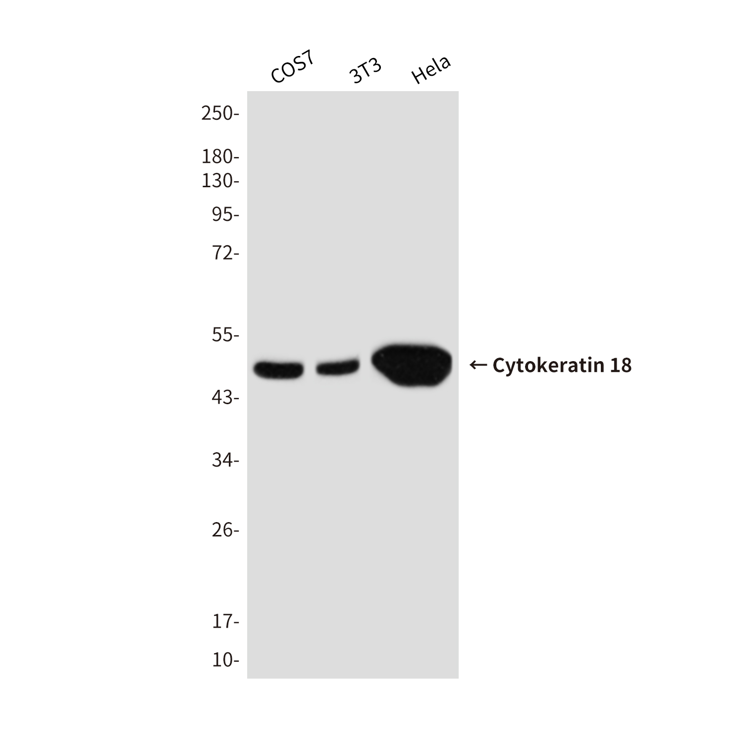 Cytokeratin 18 Mouse mAb ABZ4277