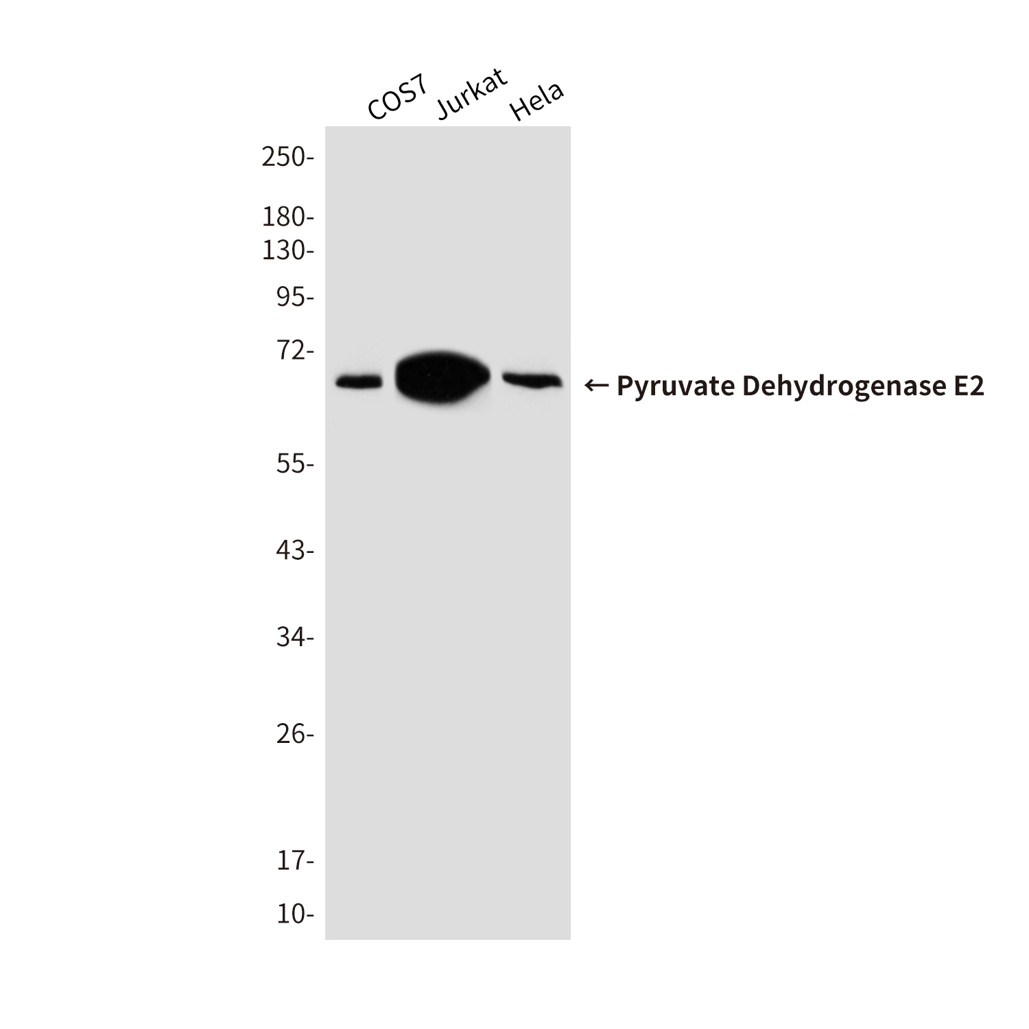 Pyruvate Dehydrogenase E2 Mouse mAb ABZ4279