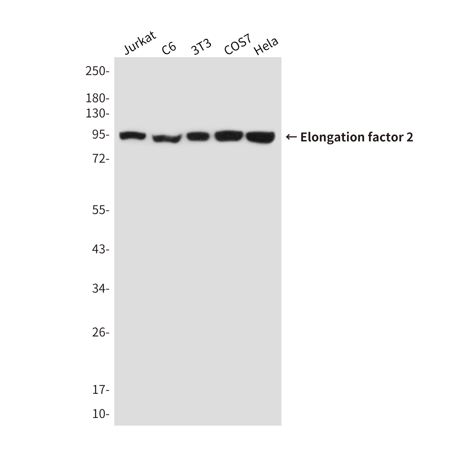 EEF2/Elongation factor 2 Mouse mAb ABZ4283