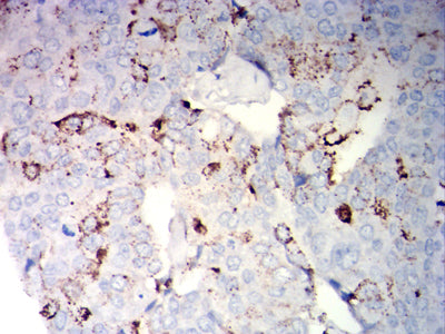 NCAM1 Mouse mAb ABZ4309