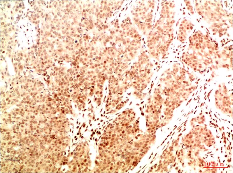 Acetyl-NF-KB p65 (Lys314/Lys315) (5F4) Mouse mAb ABZ4311