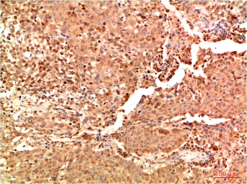 Acetyl-NF-KB p65 (Lys314/Lys315) (5F4) Mouse mAb ABZ4311