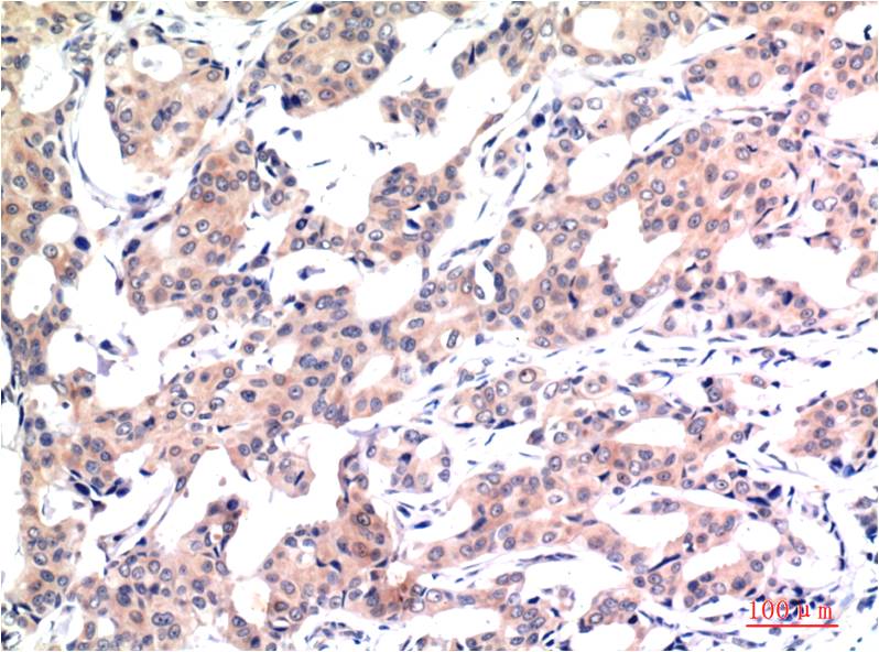 Acetyl-Histone H3 (Lys9) (10F10) Mouse mAb ABZ4313