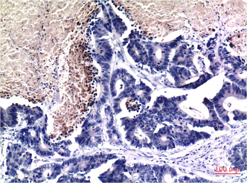 Acetyl-Histone H3 (Lys9) (10F10) Mouse mAb ABZ4313